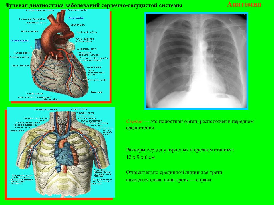 Лучевая диагностика органов средостения презентация