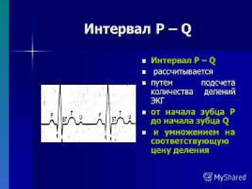 Основы экг презентация