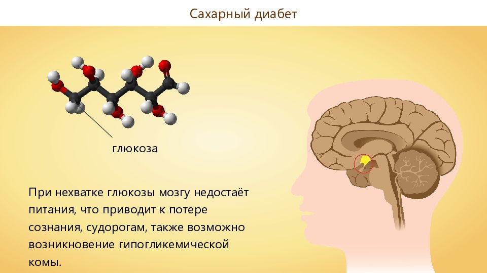 Мозг человека без кислорода. Глюкоза для мозга. Недостаток сахара. Глюкоза и головной мозг. Сахар для головного мозга.