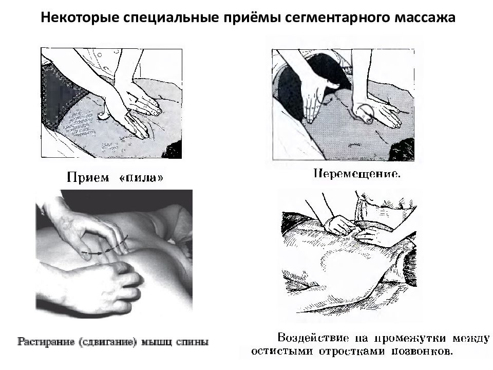 Рефлекторные приемы. Приемы сегментарно рефлекторного массажа. Основные приемы рефлекторно сегментарного массажа. Схемы для рефлекторно-сегментарного массажа. Приемы«сверление». Рефлекторно сегментарного массажа.