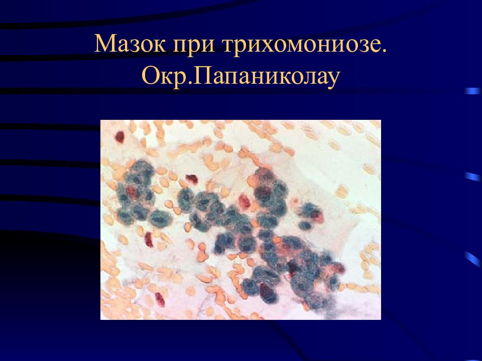 Мазок по папаниколау. Окраска по Папаниколау цитология. Окраска Папаниколау метод. Окраска по Папаниколау результат.