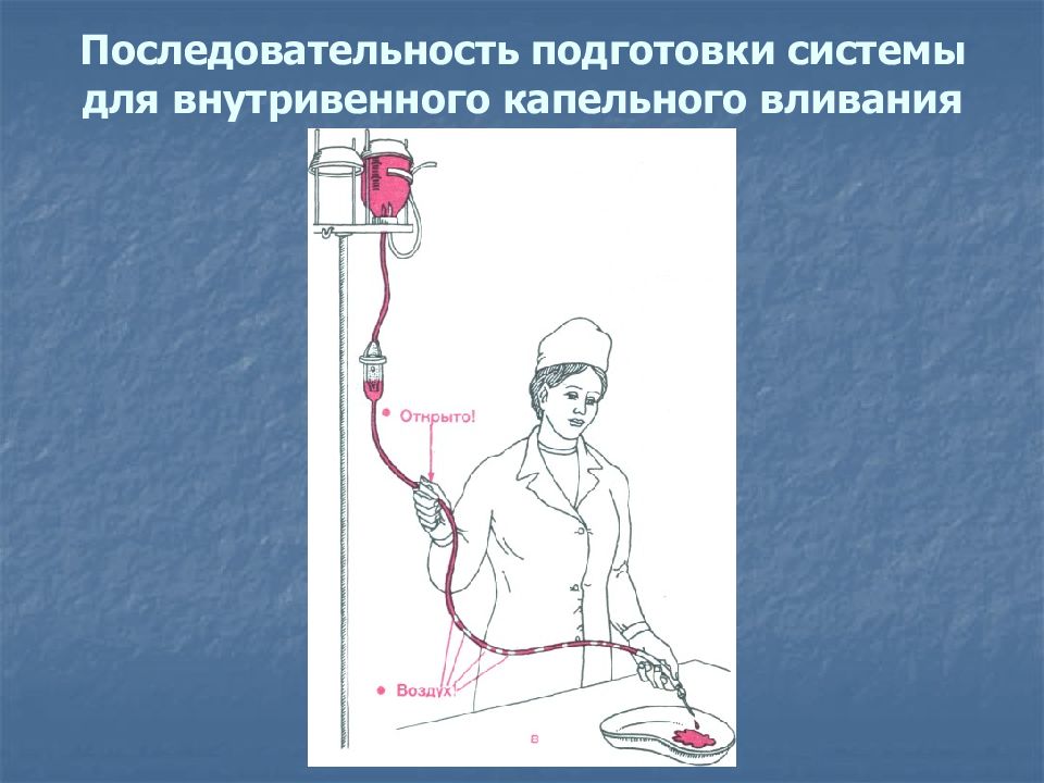 Заполнение системы. Система для внутривенного капельного вливания. Система для внутривенного вливания алгоритм. Постановка системы для внутривенных вливаний.. Постановка капельницы алгоритм.