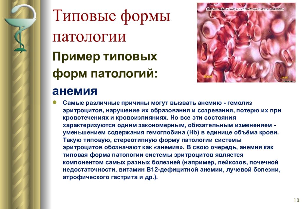 Формы патологии. Типовые формы патологии органов и функциональных систем. Типовые формы патологии примеры. Типовые патологические формы это.