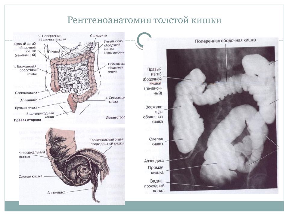 Изгиб кишечника. Рентген анатомия Толстого кишечника. Подвздошная кишка анатомия строение. Поперечная ободочная кишка синтопия. Скелетотопия поперечной ободочной кишки.