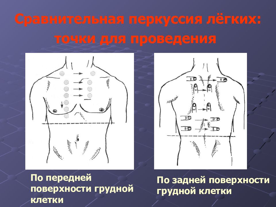 Перкуссия легких сравнительная и топографическая. Точки сравнительной перкуссии легких. Сравнительная перкуссия. Сравнительная перкуссия легких. Сравнительная перкуссия грудной клетки.