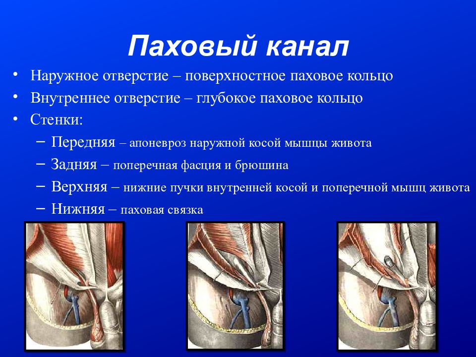 Бедренный канал рисунок