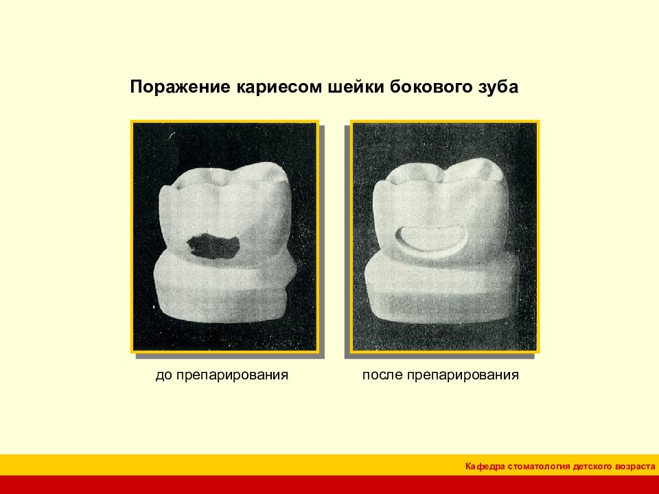 Презентация 2 класс по блэку