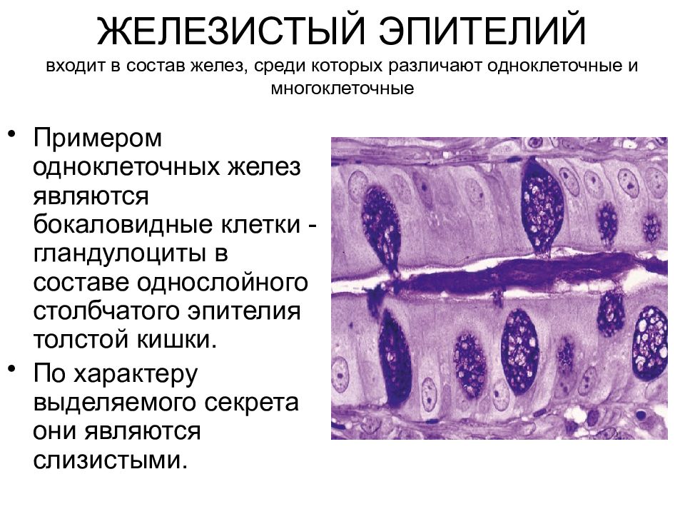 Железистый эпителий рисунок