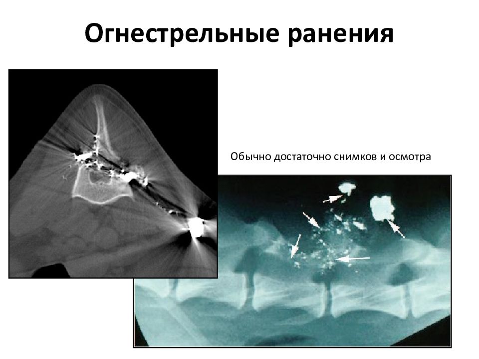 Компьютерная томография в неврологии презентация