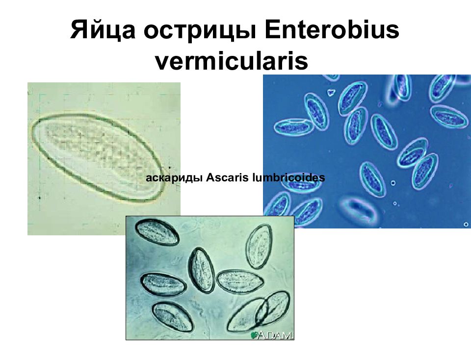 Яйца остриц. Enterobius vermicularis яйца. Яйцо энтеробиуз вермикулчрис. Энтеробиоз яйца остриц. Яйцо острицы (Enterobius vermicularis)..