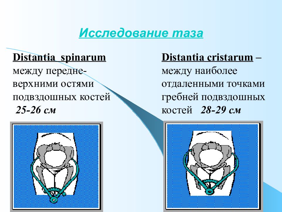 Исследование таза