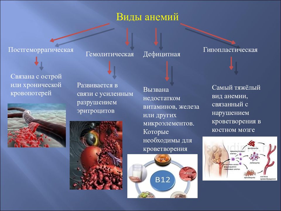 В основе анемии лежит. Виды анемий. Тип анемии при дефиците железа. Виды игемии. Постгеморрагическая анемия виды.