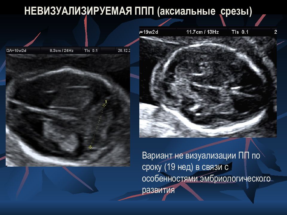 Эсетов мурад узи. Эсетов Мурад Азединович УЗИ-специалист. Эсетов Мурад Азединович УЗИ-специалист отзывы. Эсетов Мурад Азединович УЗИ-специалист биография.