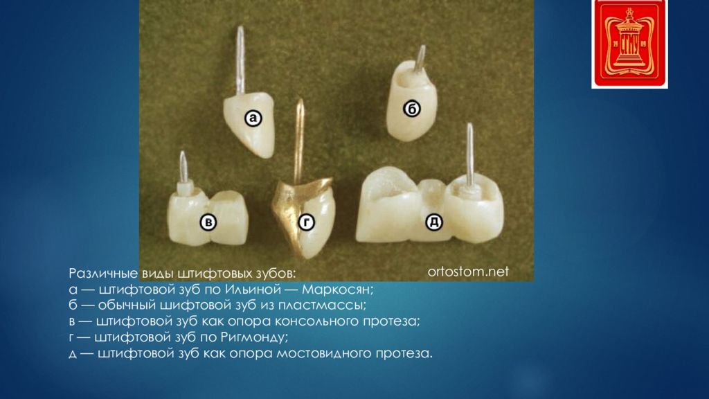 Показания к применению штифтовых. Штифтовой зуб по Ильиной-Маркосян. Штифтовые зубы по конструкции. Штифтовой зуб с кольцом по Ричмонду.