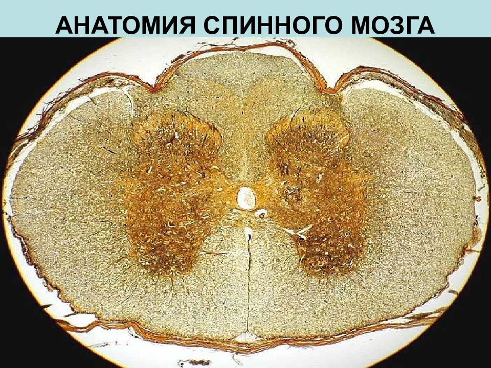 Спинной мозг фото. Спинной мозг препарат анатомия. Поперечный срез спинного мозга под микроскопом. Субатрофия спинного мозга.