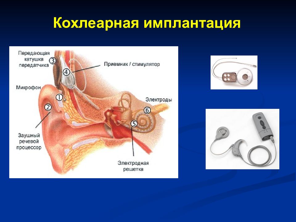 Методы исследования слухового анализатора презентация