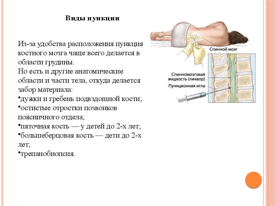 Пункция костного мозга для чего. Взятие пункции костного мозга. Как берут костный мозг на анализ. Методика проведения костномозговой пункции. Пункция костного мозга грудины что.