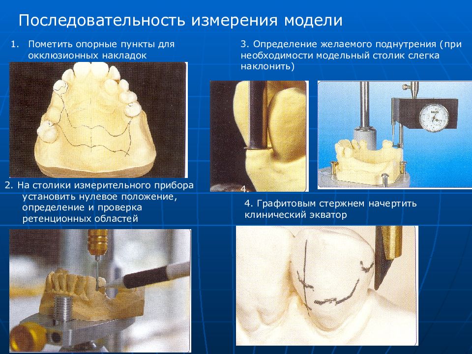 Ретенционные аппараты презентация