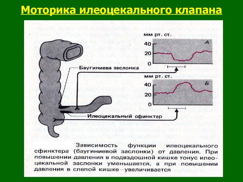 Баугиниевая заслонка кишечника где находится. Илеоцекальный клапан баугиниева заслонка. Баугиниева заслонка кишечника. Недостаточность баугиниевой заслонки. Моторная функция Толстого кишечника.