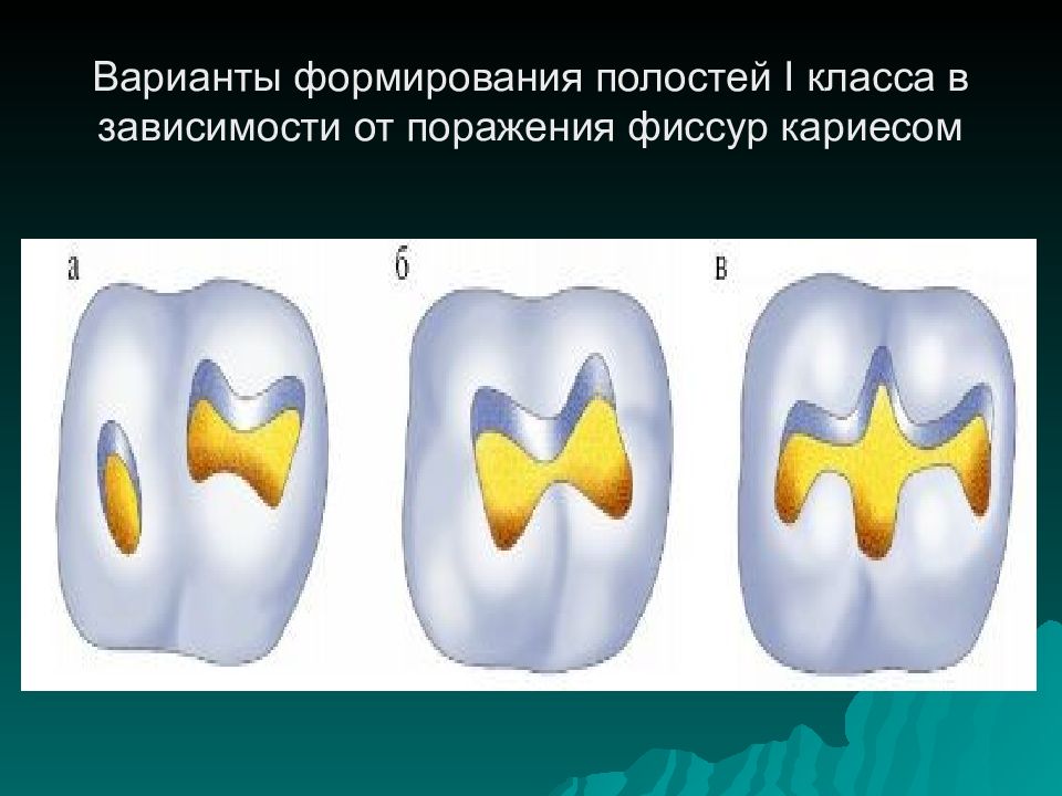 4 класс по блэку презентация