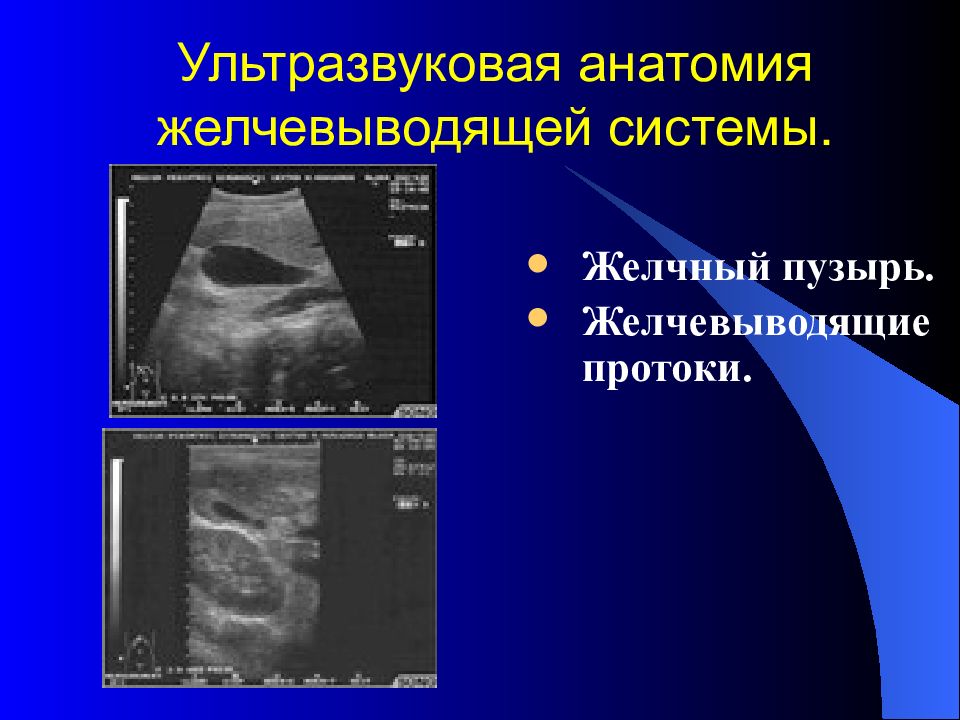 Лучевая диагностика брюшной полости презентация