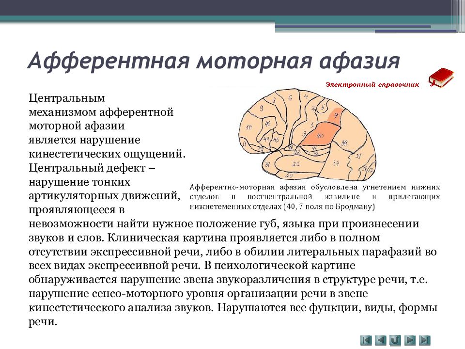 Онмк моторная афазия карта вызова