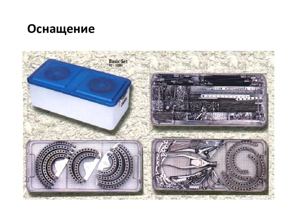 Аппарат Илизарова — презентация