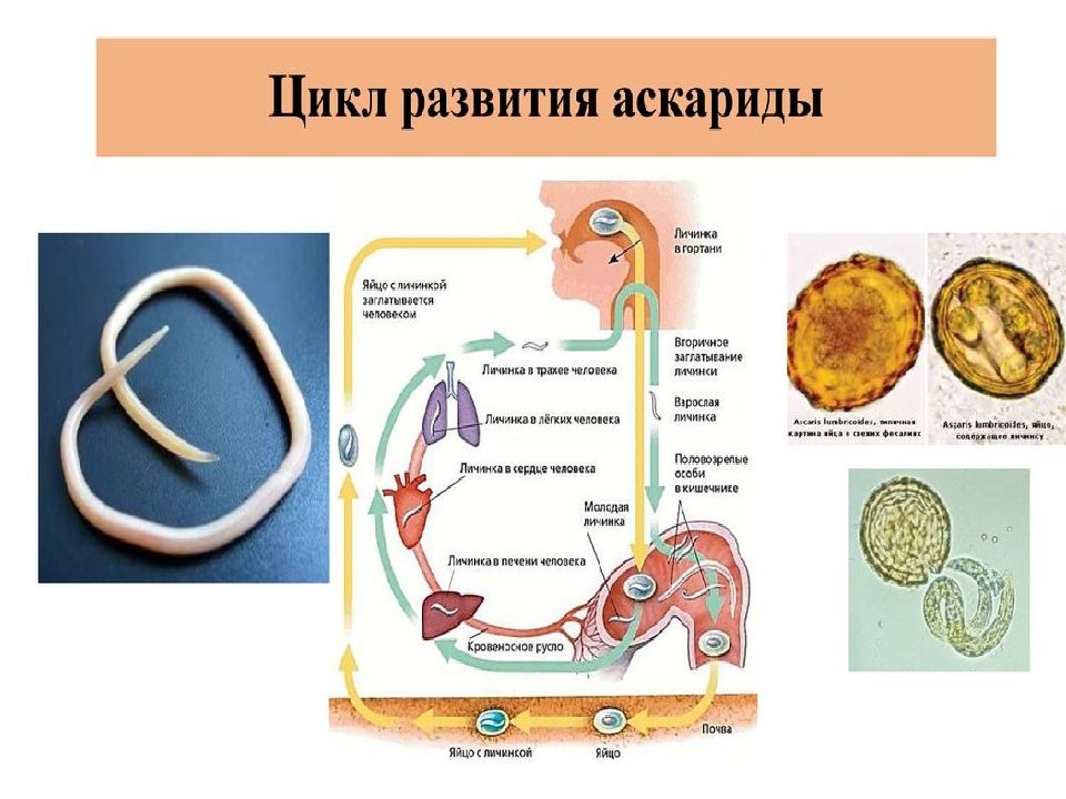 Что такое гельминтология. Гельминтология презентация. Медицинская гельминтология презентация. Тип круглые черви медицинская гельминтология. Гельминтология это наука.