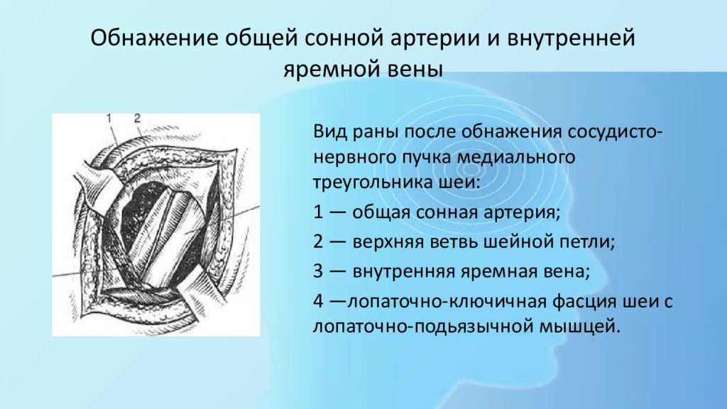 Оперативная хирургия головы и шеи презентация