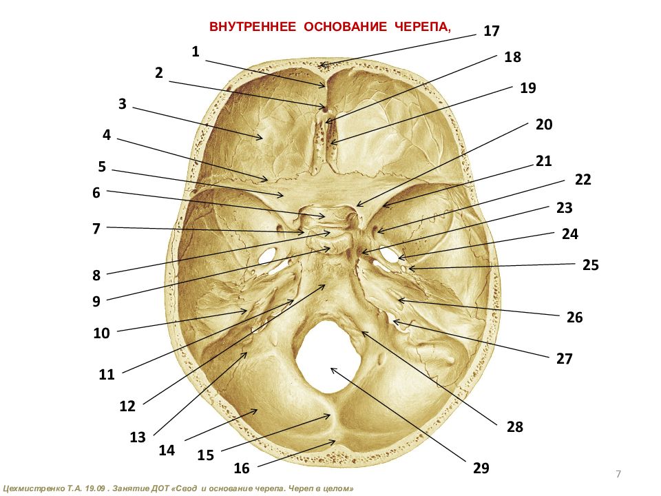 Свод и основание черепа