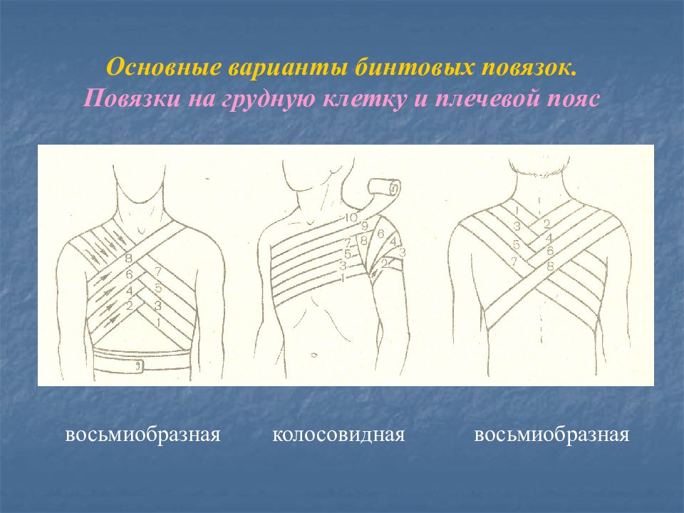 Техника наложения повязок на грудную клетку
