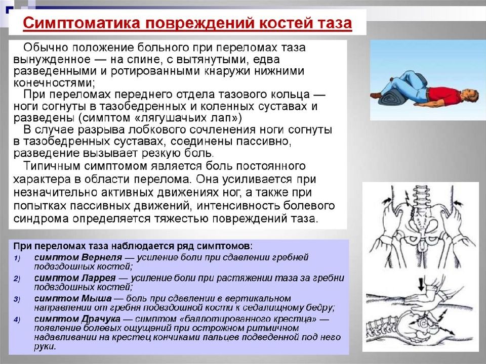 Травма таза презентация