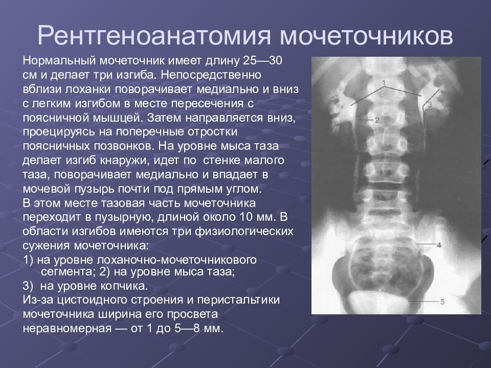 Лучевая диагностика почек презентация