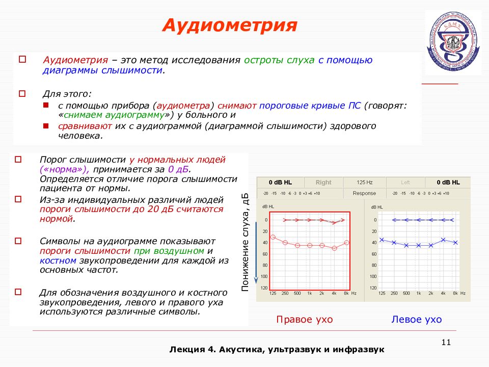 Диаграмма слуха человека