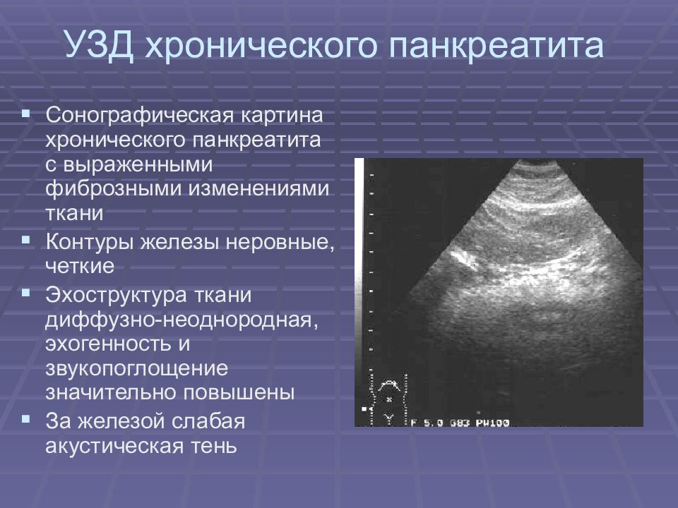 Неровные четкие контуры поджелудочной