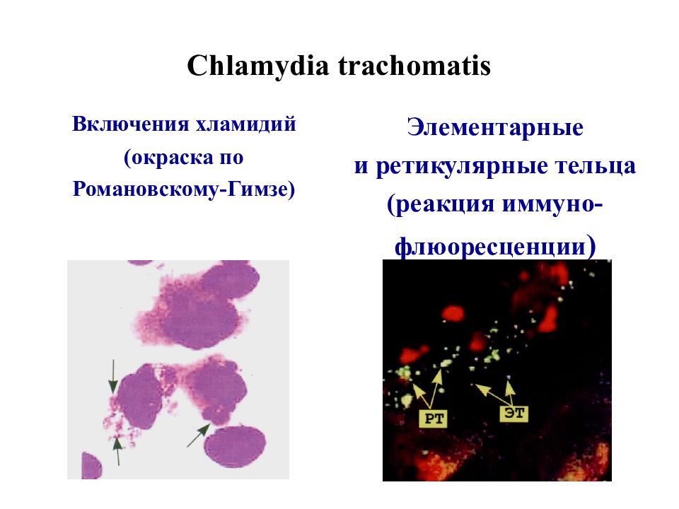 Элементарные тельца хламидий