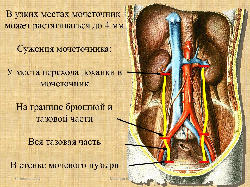 Мочеточник на картинке