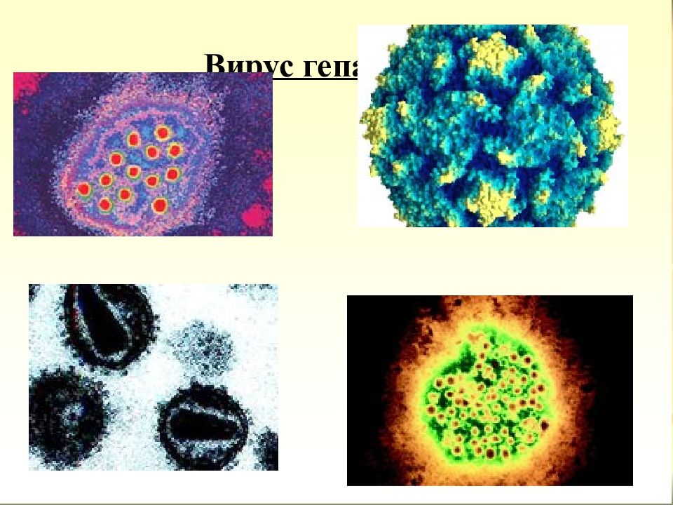 Вирусный гепатит а презентация