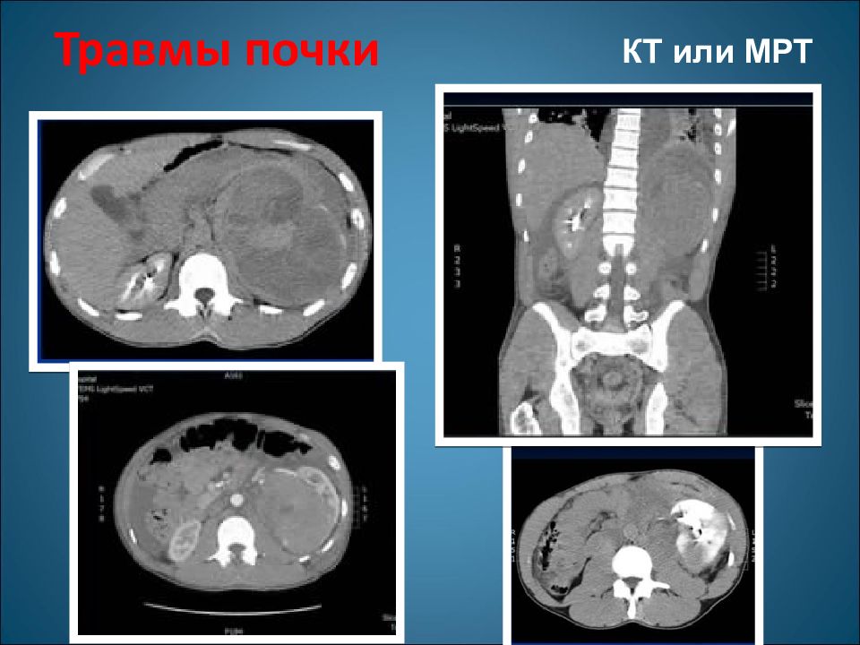 Кт почек презентация