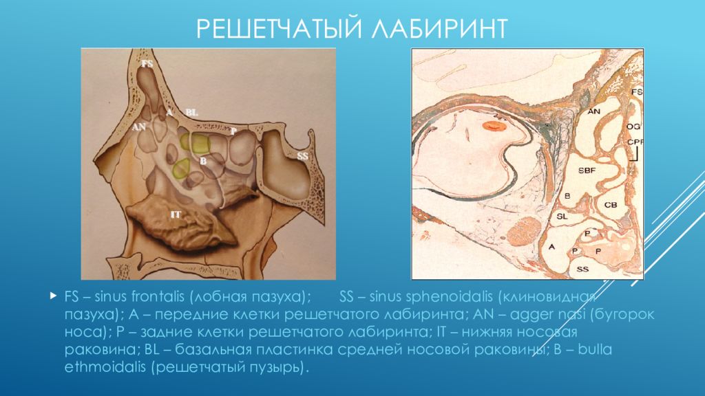 Рак полости носа и придаточных пазух презентация