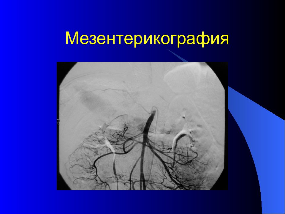 Лучевая диагностика брюшной полости презентация