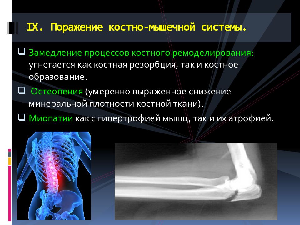 Заболевания костно мышечной системы презентация