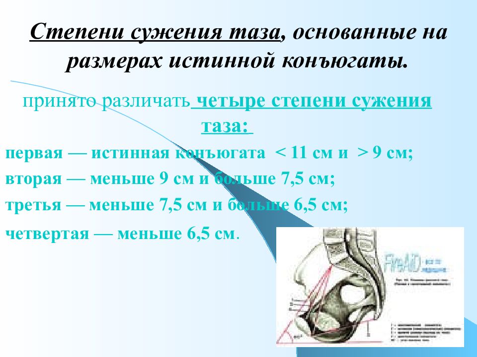 Размеры женского таза презентация