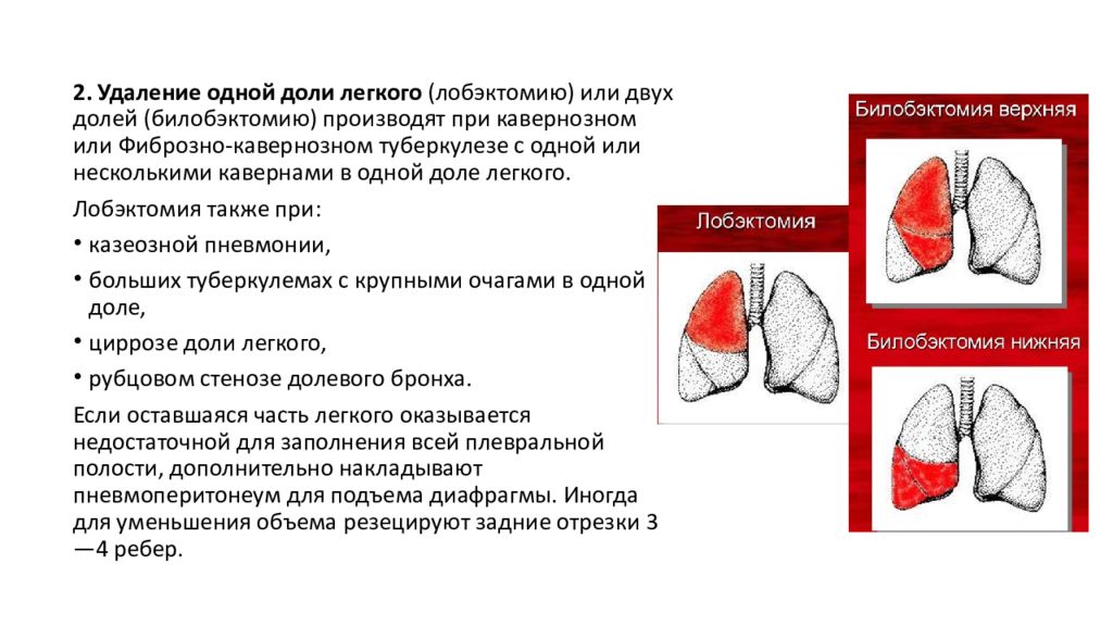 Хирургическое лечение туберкулеза презентация