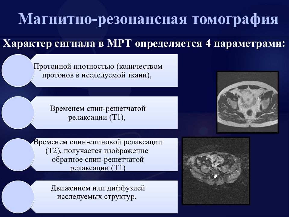 Т1 взвешенное изображение мрт