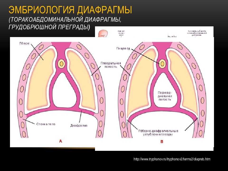 Диафрагмальные грыжи у детей презентация