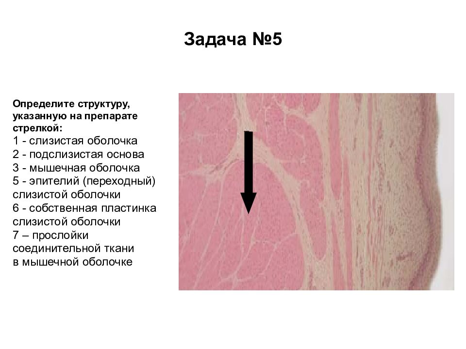 Мышечная пластинка слизистой оболочки латынь. Подслизистая основа латынь. Какое значение имеет подслизистая основа. Подслизистое образование как отличить от внутримышечного.