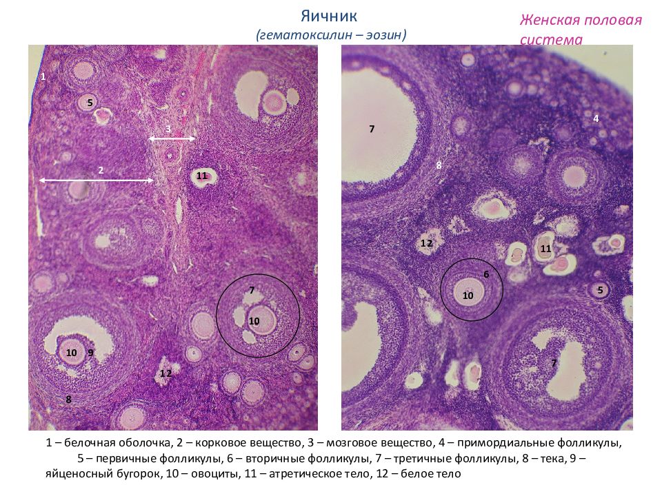 Яичник препарат гистология рисунок