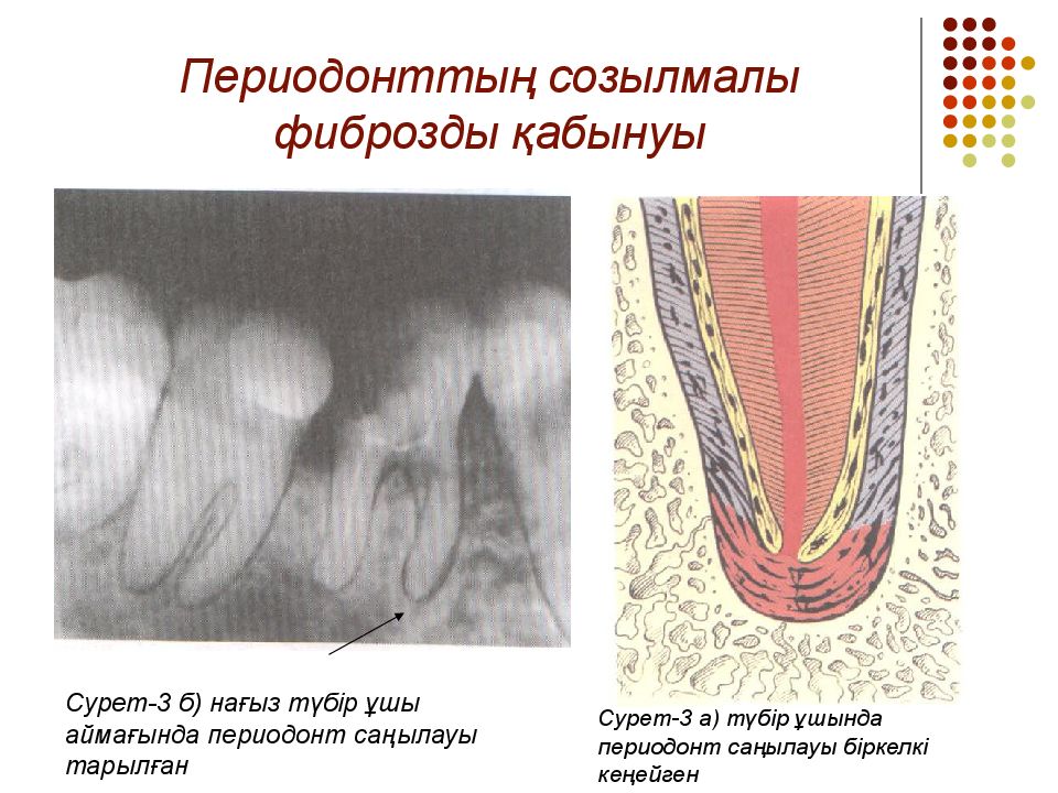 Периодонт. Периодонт презентация. Сформированный периодонт.