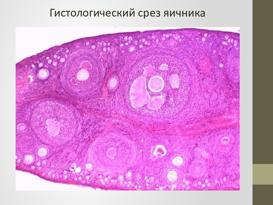 Яичник препарат гистология рисунок